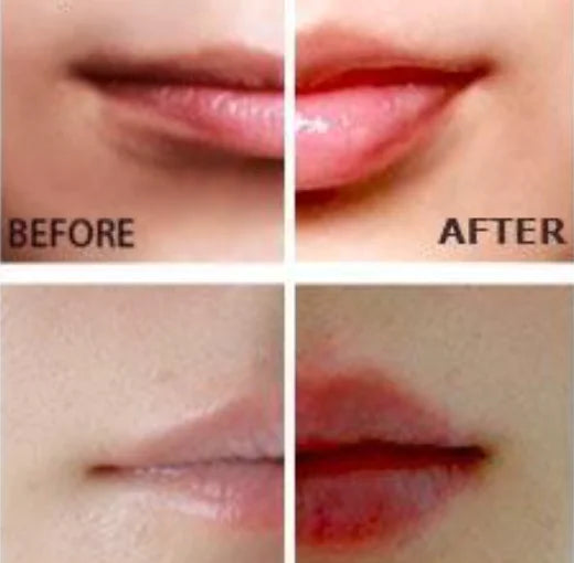Miracle Lip Plumper - Image #0